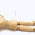 しぶとい腰痛に初めての針治療。筋肉が固まる原因と、針が効く理由